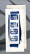 tooth x-ray dental
